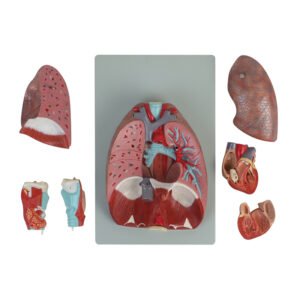 Magnified Model Of Larynx Heart And Lung Paper Corner